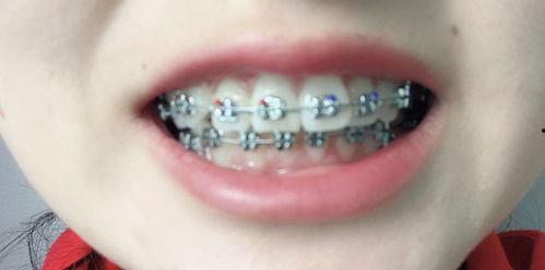 成人眼神矫正方法视频,成人眼神矫正方法视频解析