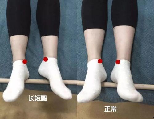 成人长短腿调节视频,跟随专业视频，轻松改善步态平衡