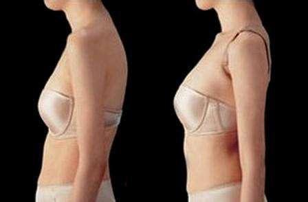 驼背成人改善方法视频,跟随专业视频，轻松恢复挺拔身姿